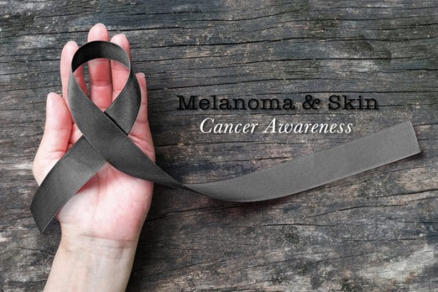 Let's fight against Cancer: Types of Cancer - Skin cancer