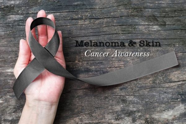 Let's fight against Cancer: Types of Cancer - Skin cancer